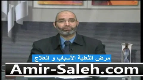 مرض الثعلبة الأسباب و العلاج