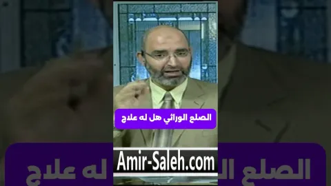 الصلع الوراثي هل له علاج