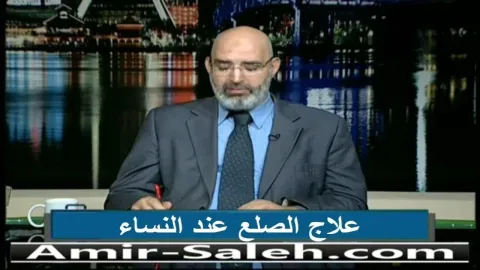 علاج الصلع عند النساء