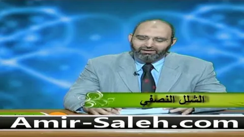 الشلل النصفي  | الطب الآمن