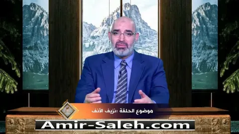 نزيف الأنف أو الرعاف  | برنامج عرض ومرض