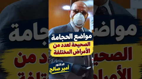 مواضع الحجامة الصحيحة لعدد من الأمراض المختلفة
