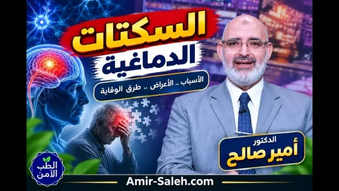السكتات الدماغية (جلطات المخ) .. الأسباب والأعراض وطرق الوقاية | الطب الآمن