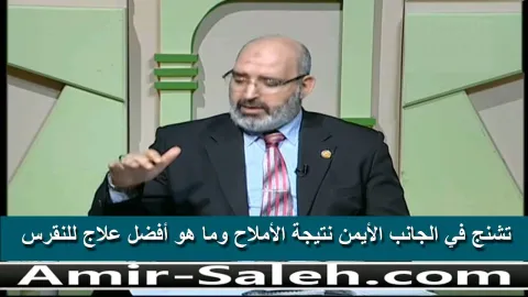 تشنج في الجانب الأيمن نتيجة الأملاح وما هو أفضل علاج للنقرس