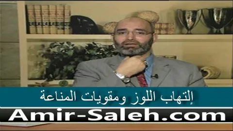 إلتهاب اللوز ومقويات المناعة