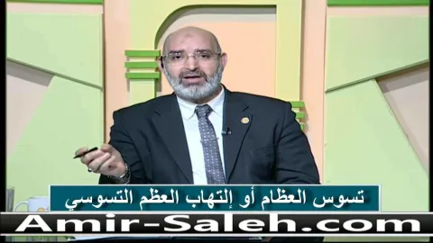 تسوس العظام أو إلتهاب العظم التسوسي  | الطب الآمن